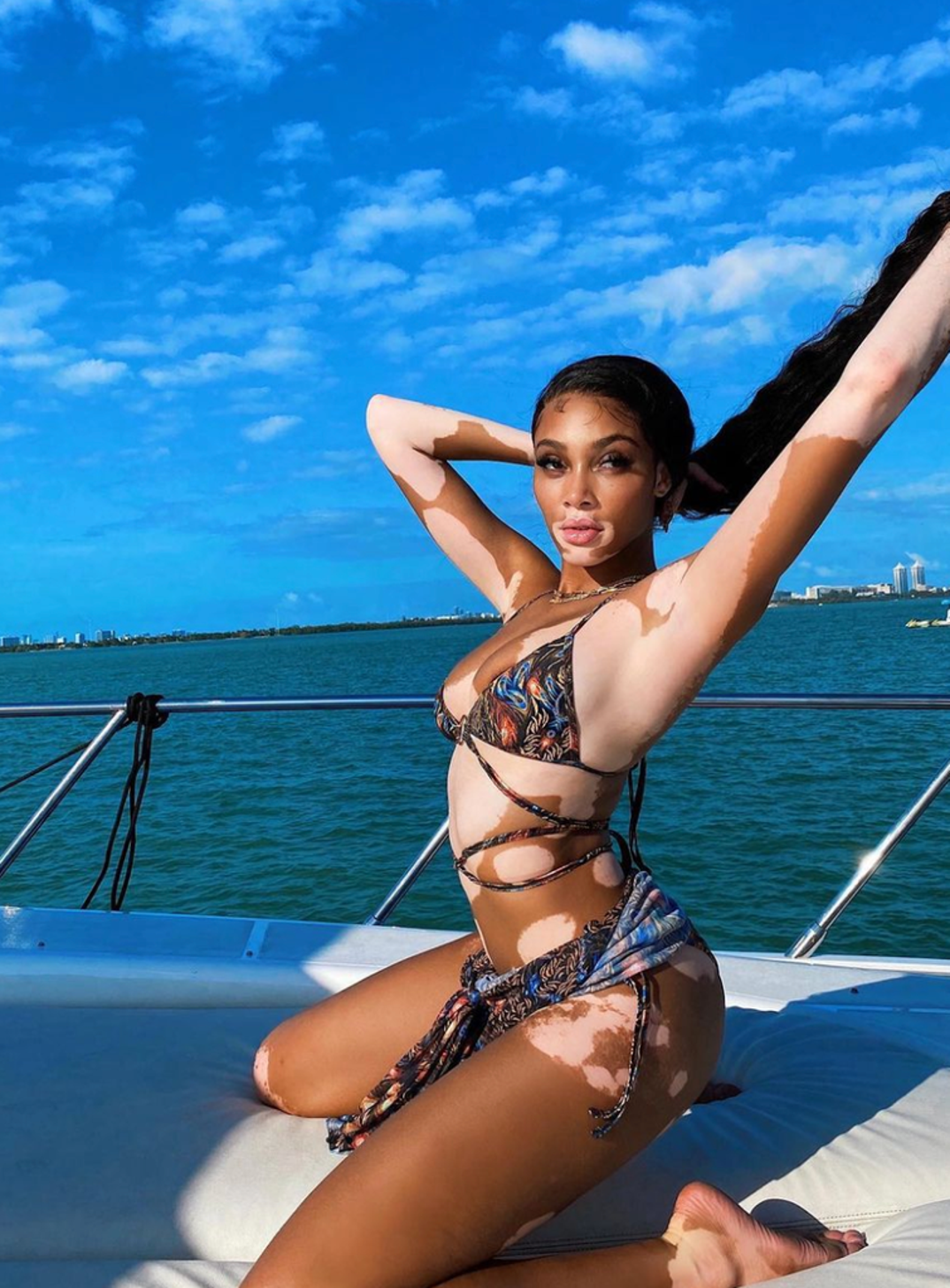 winnie-harlow-hot-bday-photos5