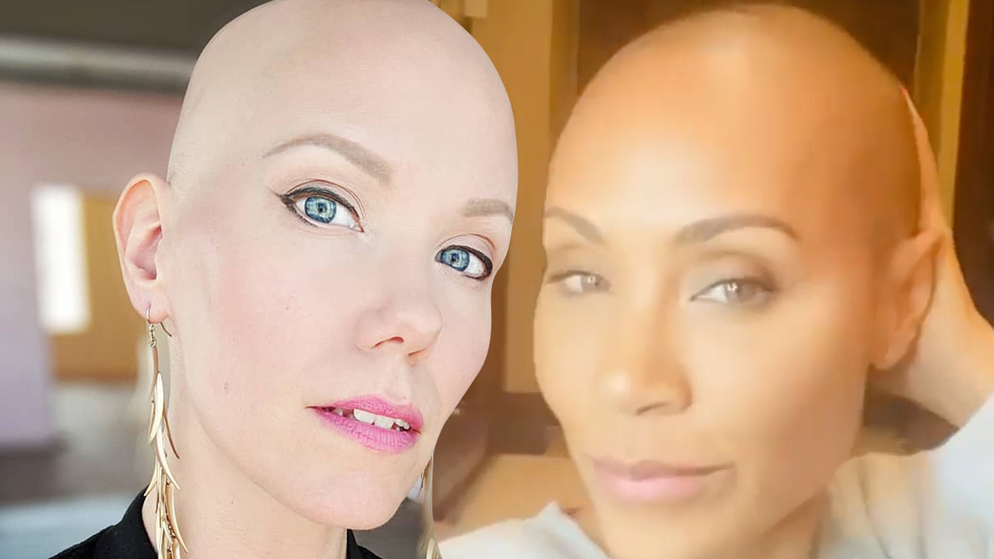 'Hollywood's Bald Blonde' Jannica Olin on Alopecia, Chris Rock's Joke