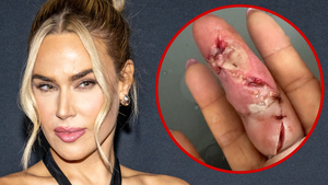 AEW Star CJ Perry Hospitalized W/ Gruesome Finger Infection