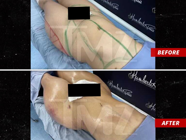 Tekashi 6ix9ine's Baby Mama Has Medical Scare After Brazilian Butt Lift