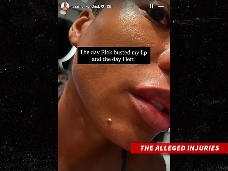 rick-ross-The-Alleged-Injuries-ig-1