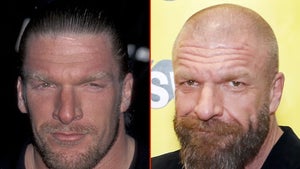 Triple H -- Good Genes or Good Docs?!