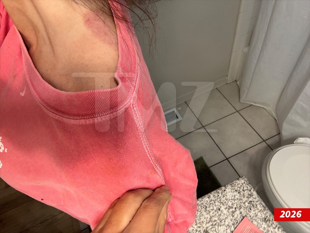 Dakota-Mortensen-Alleged-Injuries-Swipe- 3