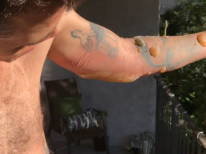 070617_steve_o_injuries_primary