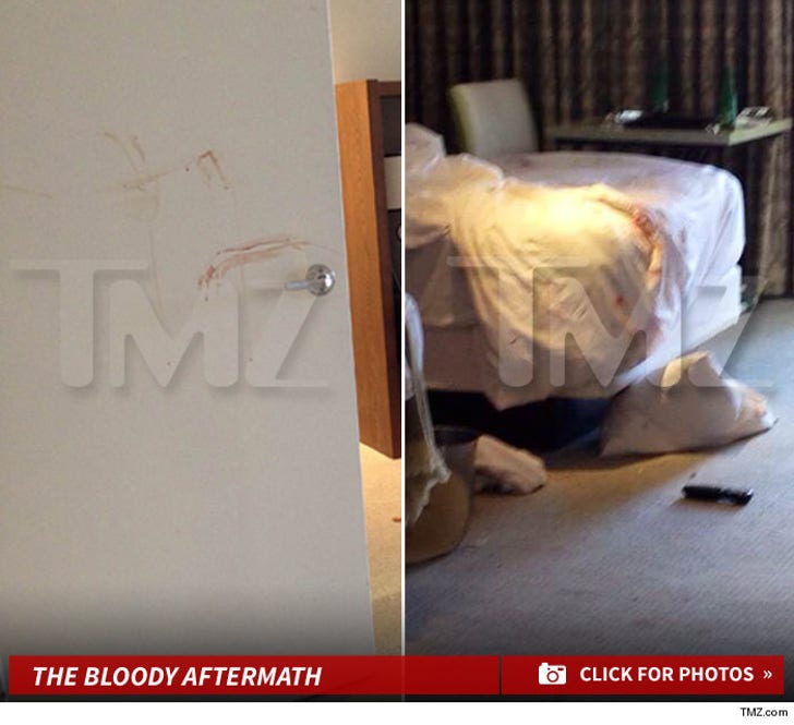 Brittny Gastineau and Retna's Hotel Room -- The Bloody Aftermath