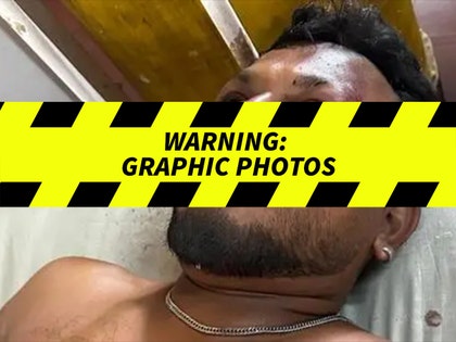 british survivor of india plane crash injuries 1