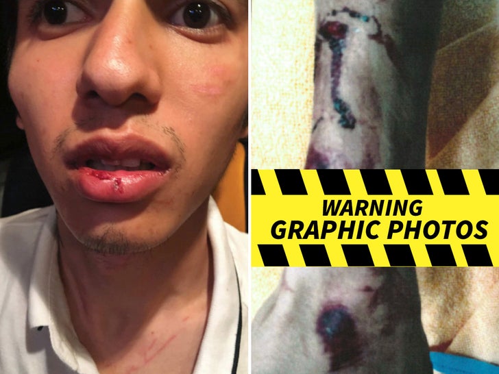 A$AP Rocky -- Alleged Victim Injury Photos