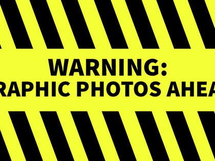 warning-graphic-photos-2