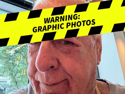 0723-Ric-Flair-Forehead-Graphic-Warning-PRIMARY