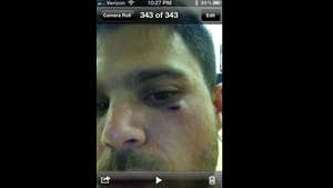 'Entourage' Star Jerry Ferrara -- Face Busted Open During Basketball Game