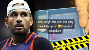 Nick Kyrgios Withdraws From Australian Open After Gross Fluid Drained From Knee