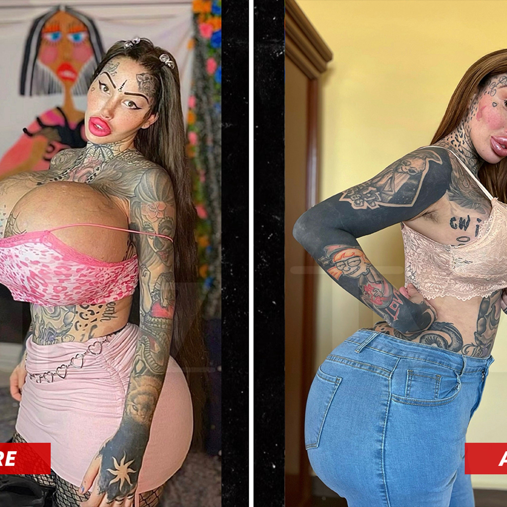 Instagram Model Loses 20 Lbs. from Breast Reduction After 38J