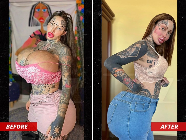 Instagram Model Loses 20 Lbs. from Breast Reduction After 38J