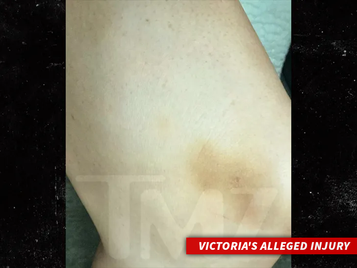 sub Victoria lee robinson Alleged Injury handout