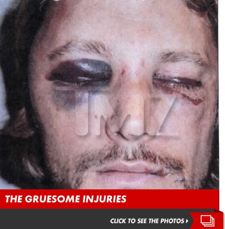 Gabriel Aubry's Gruesome Injuries