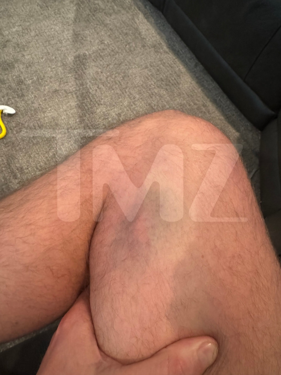 Dakota Mortensen Alleged Injuries 5