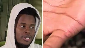 NFL's Chris Herndon Was Born with 12 Fingers, Check Out the Scars