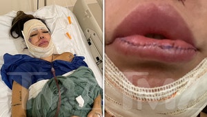 Model Liziane Gutierrez Undergoes Emergency Surgery to Remove Face Filler
