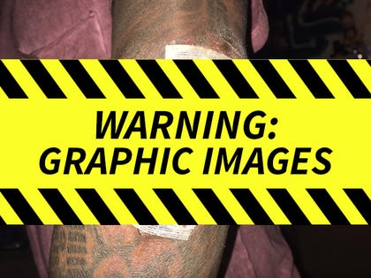 1201_lil_wayne_skateboard_injury_launch