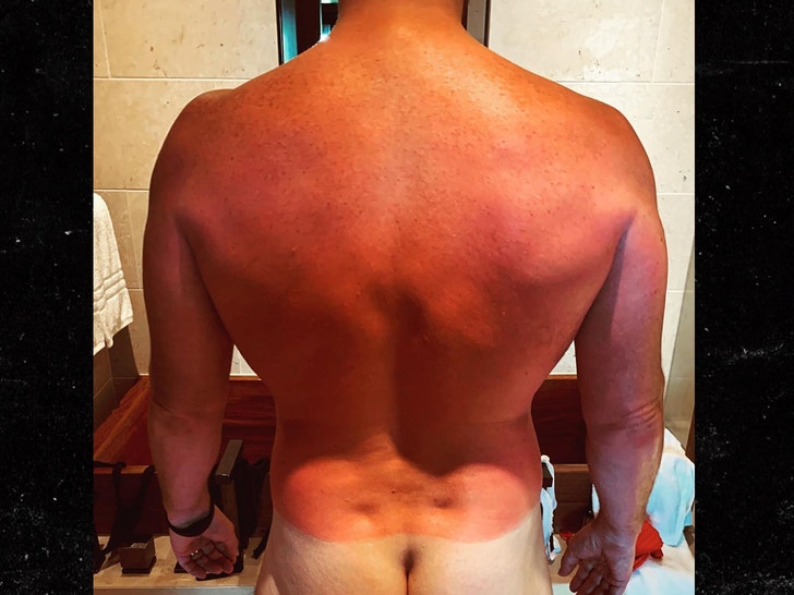 Chris Pratt Shows Off Sunburn from Hawaiian Honeymoon - TMZ