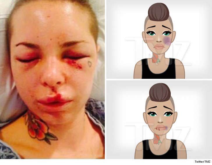 Porn Star Injuries - Porn Star Christy Mack: Creates Domestic Violence Emojis ...