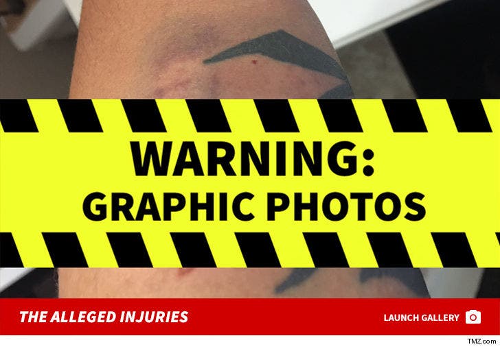 French Montana Victim Alleged Injury Photos