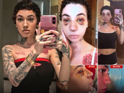 Bhad Bhabie nose job before and after insta