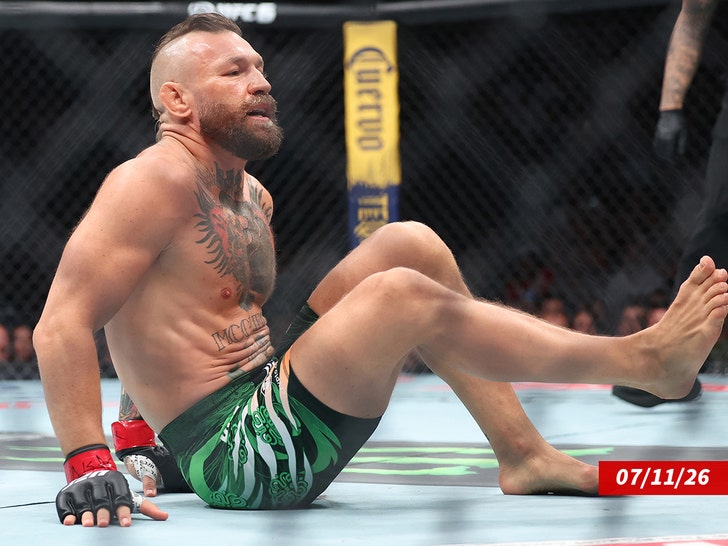 conor mcgregor injury getty