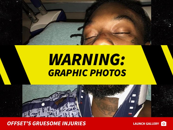 Offset's Gruesome Car Accident Pictures