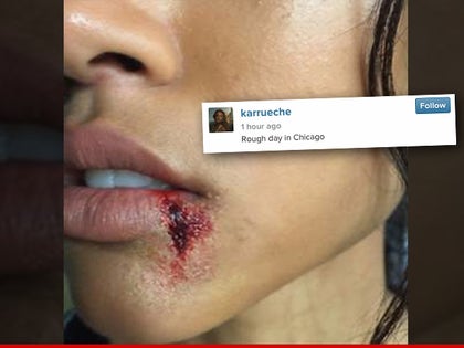 0526-karrueche-tran-bleeding-lip-INSTAGRAM-01