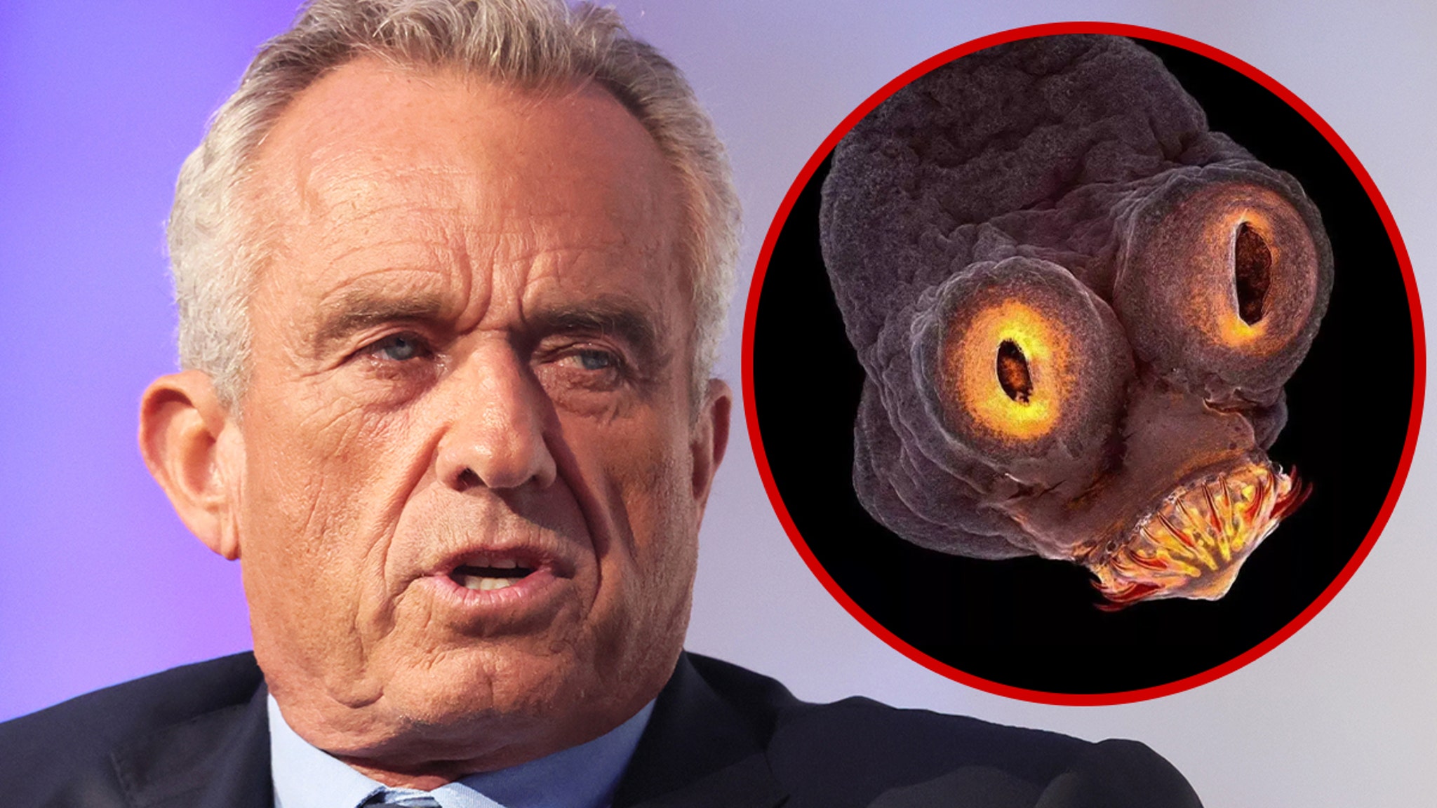 Robert F. Kennedy Jr. Says a Worm Ate Part of His Brain Years Ago