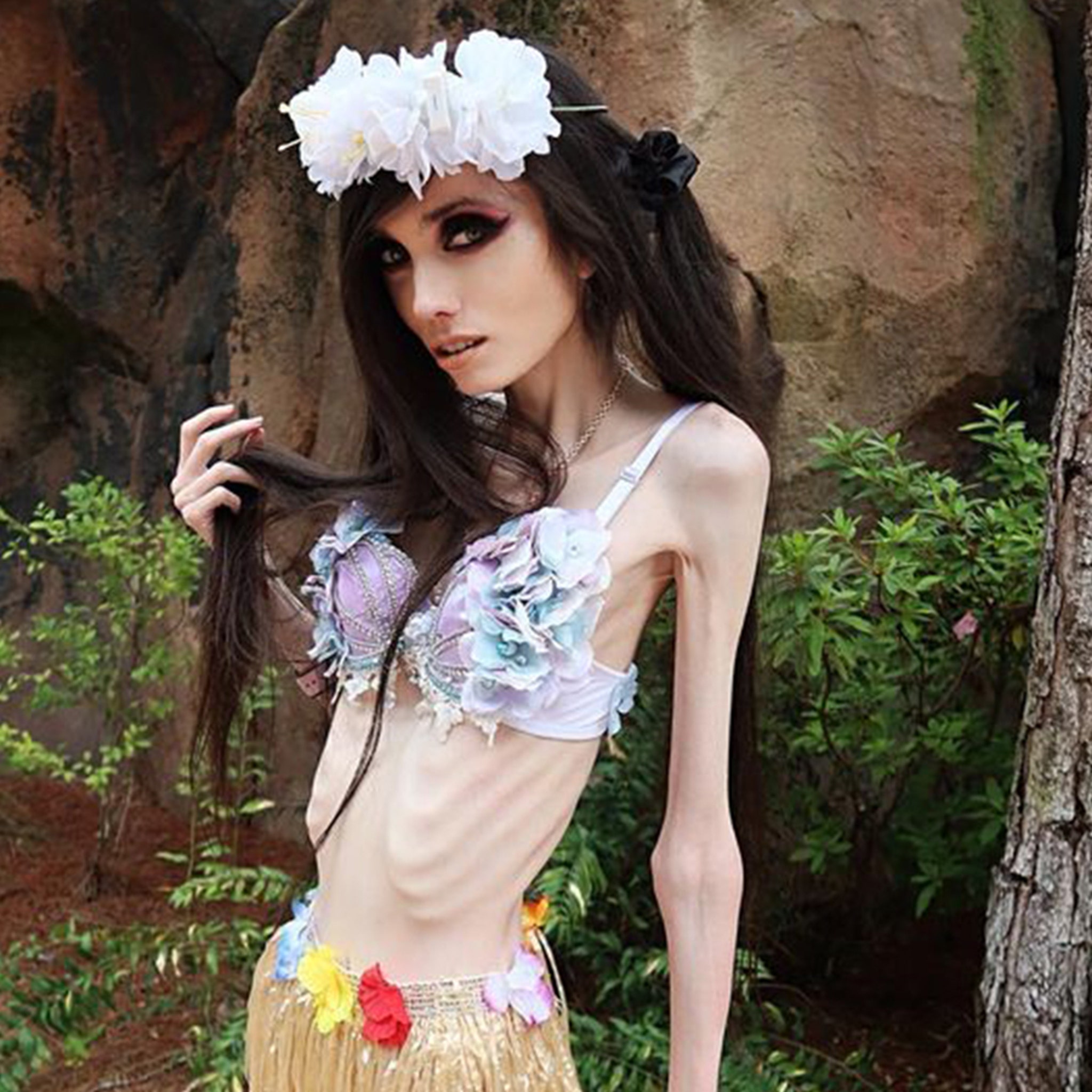 r Eugenia Cooney's Skinny and Frail Appearance Triggers 911 Calls  from Fans