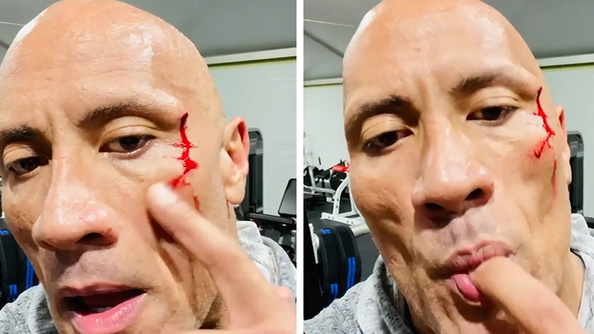 Agency News, Dwayne Johnson AKA The Rock Suffers Face Injury During  Workout (Watch Video)