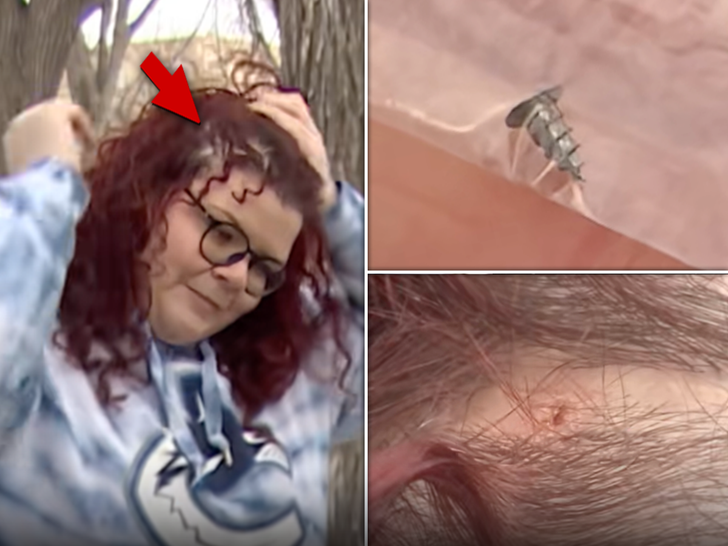 surgical screw head woman tiktok