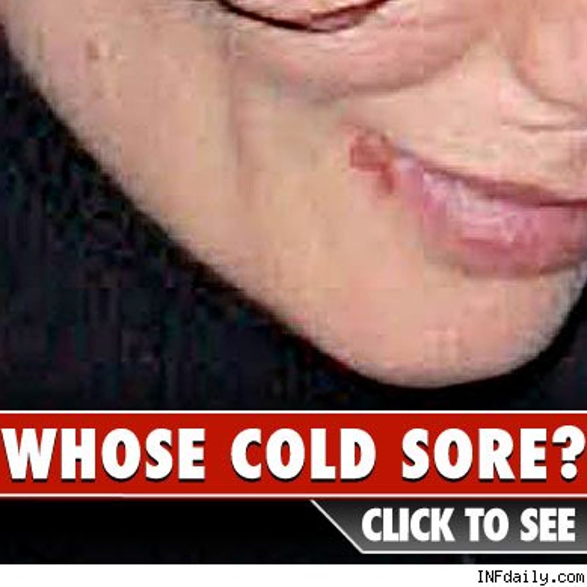 Can You Guess Who Had the Flare-up?!