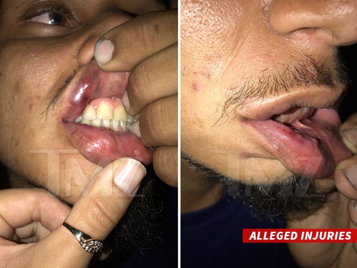 Chris Brown é acusado de bater na foto, 