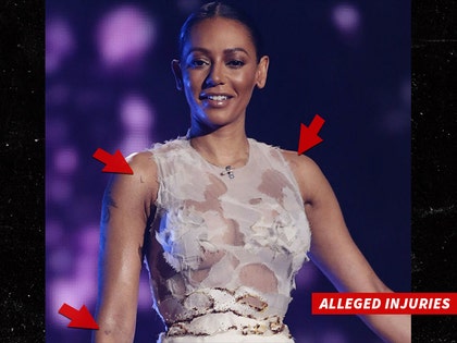 0404-mel-b-injuries-stephen-belafonte-01