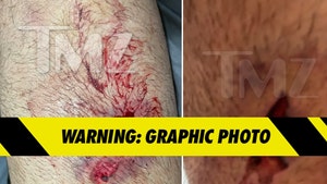 DaBaby's Entourage, Alleged Shooting Victim's Injury Photos