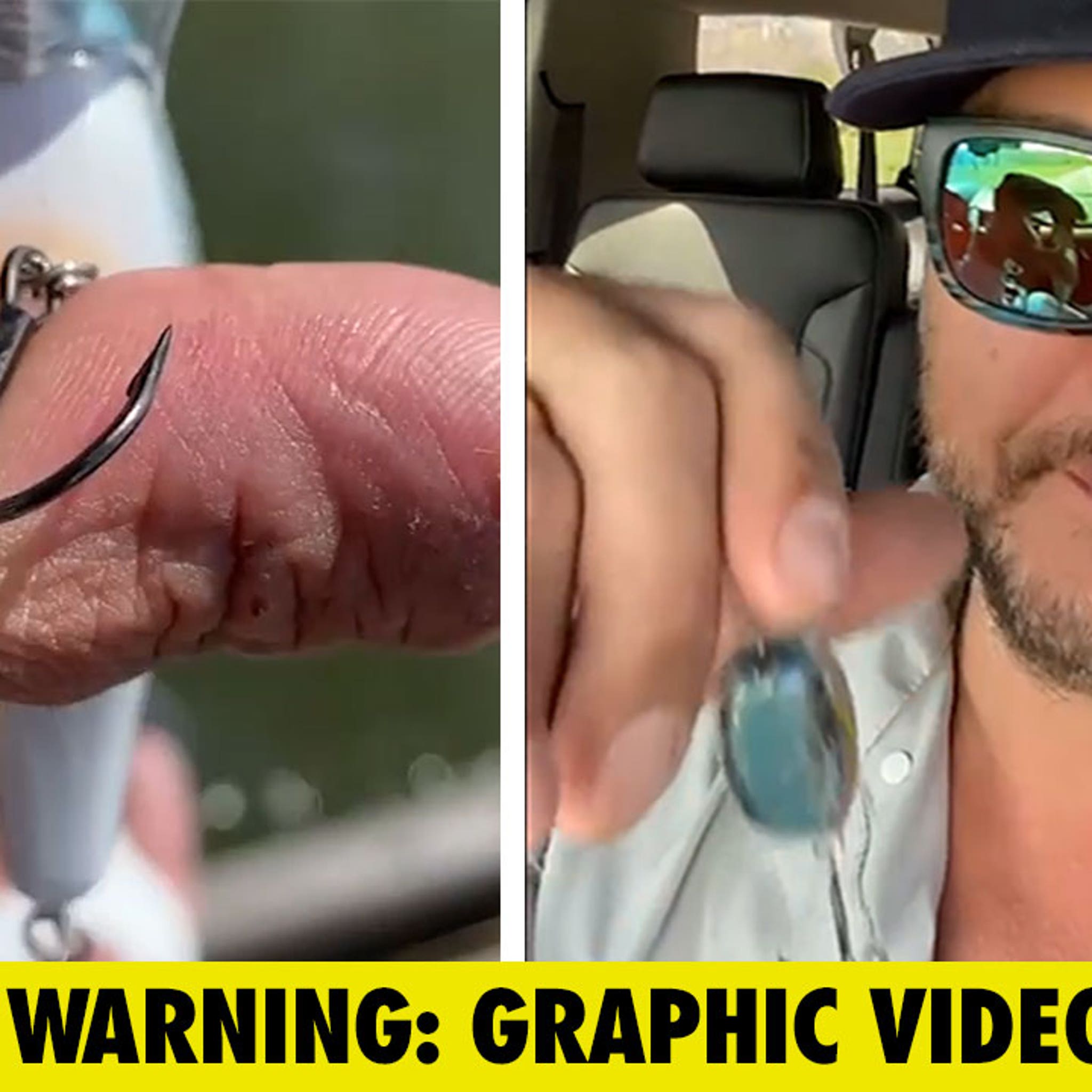 fishing hook accidents