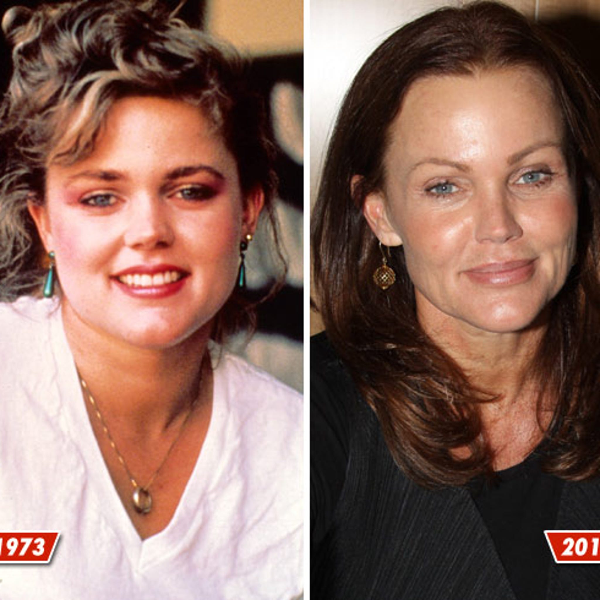 Belinda carlisle plastic surgery