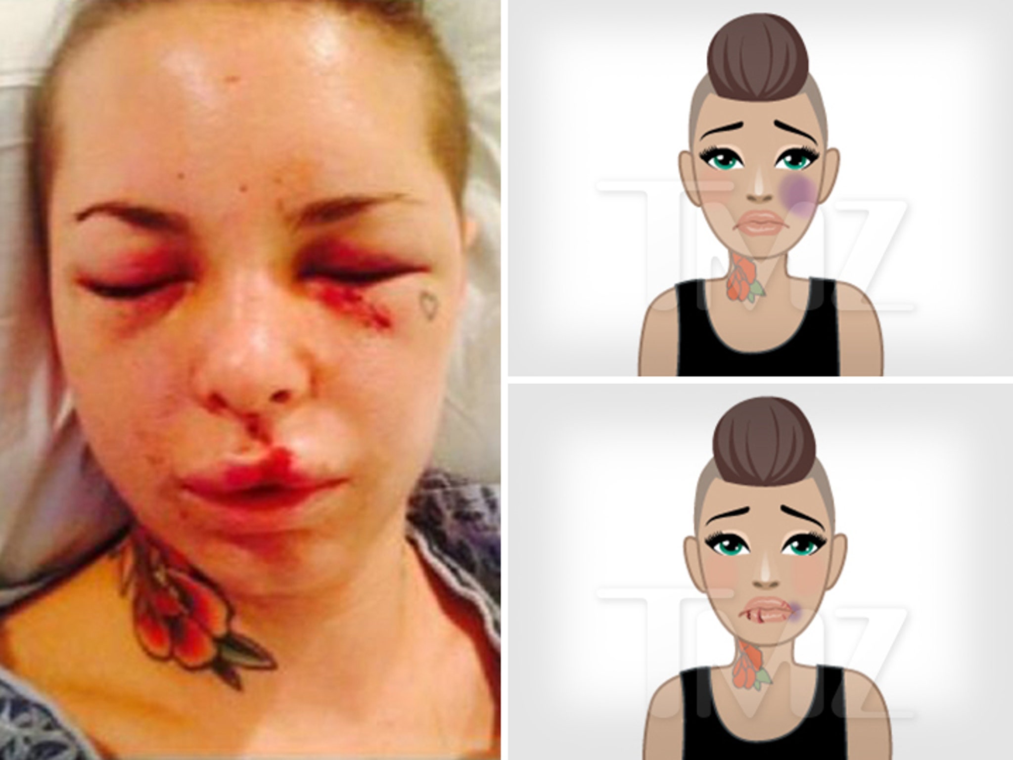 2048px x 1537px - Porn Star Christy Mack: Creates Domestic Violence Emojis ... Black Eyes,  Bruises