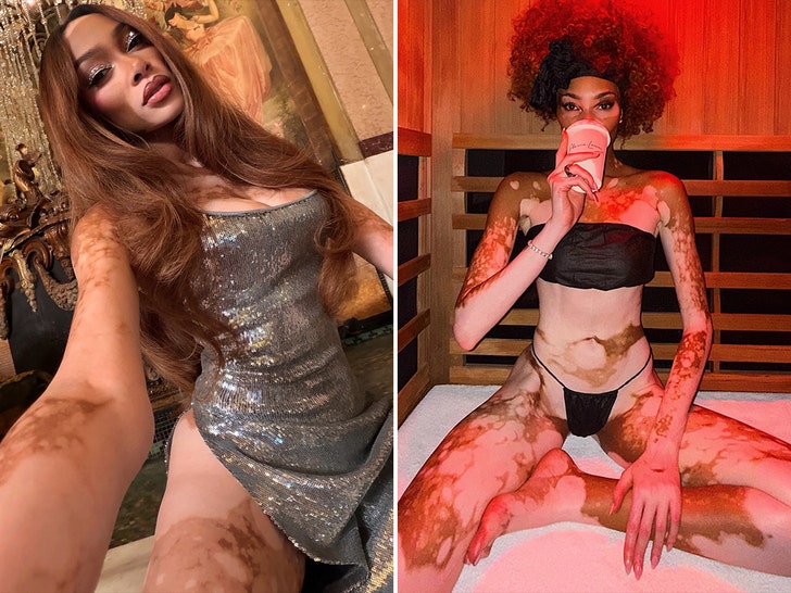 Winnie Harlow Hot Shots