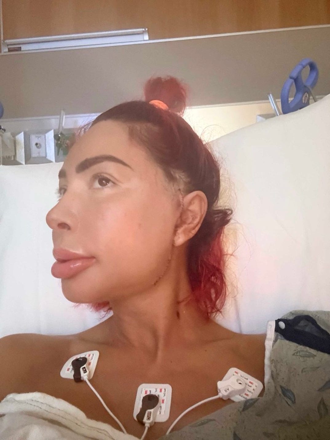 Farrah Abraham Post Op Photos 7
