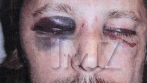 Gabriel Aubry -- My Bloody, Battered Face -- Olivier Threatened to KILL ME