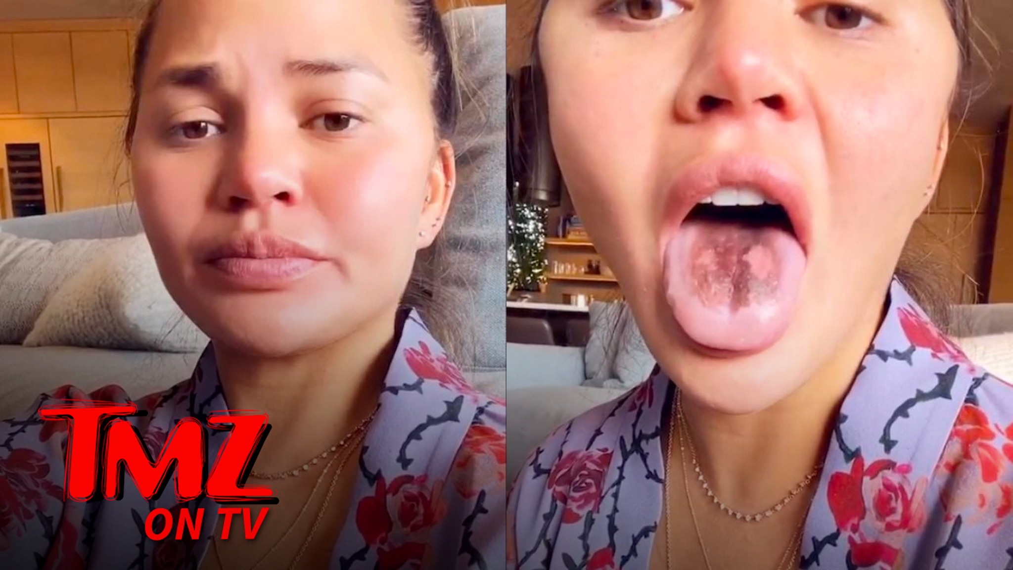 Chrissy Teigen S Tongue Is Peeling After Eating Too Much Sour Candy