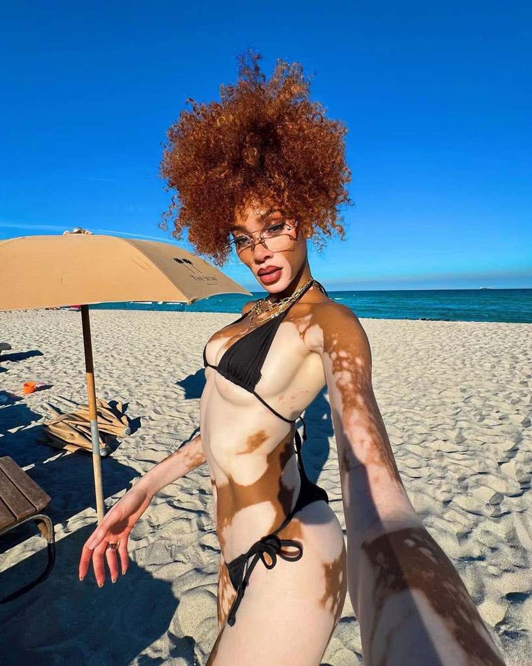 Winnie Harlow