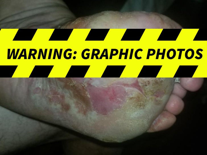 John Wayne Bobbitt -- The Gruesome Foot Injury