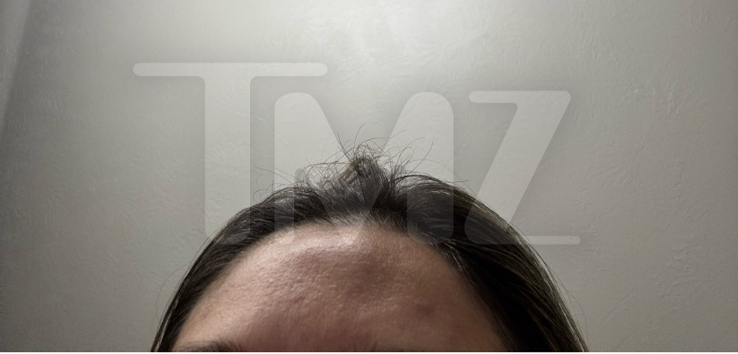 Taylor Frankie Paul Alleged Injuries  4