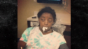 Simone Biles Drugged Up After Surgery, Watch Me Whip!