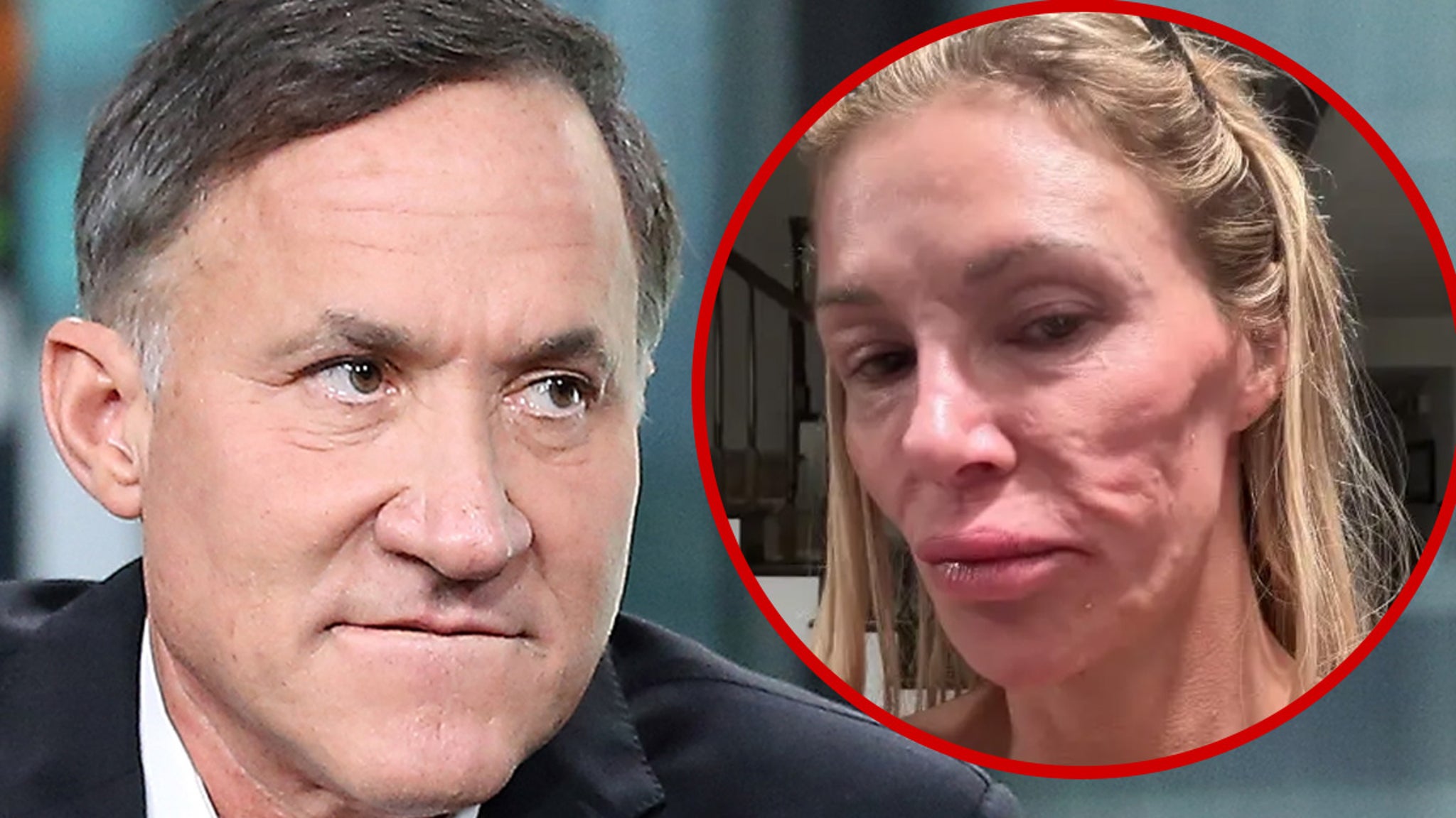 Dr. Terry Dubrow Explains Brandi Glanville’s Face Isn’t Because of Parasite